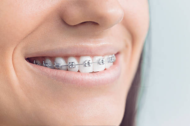 Best Wisdom Tooth Removal  in Mcnary, AZ